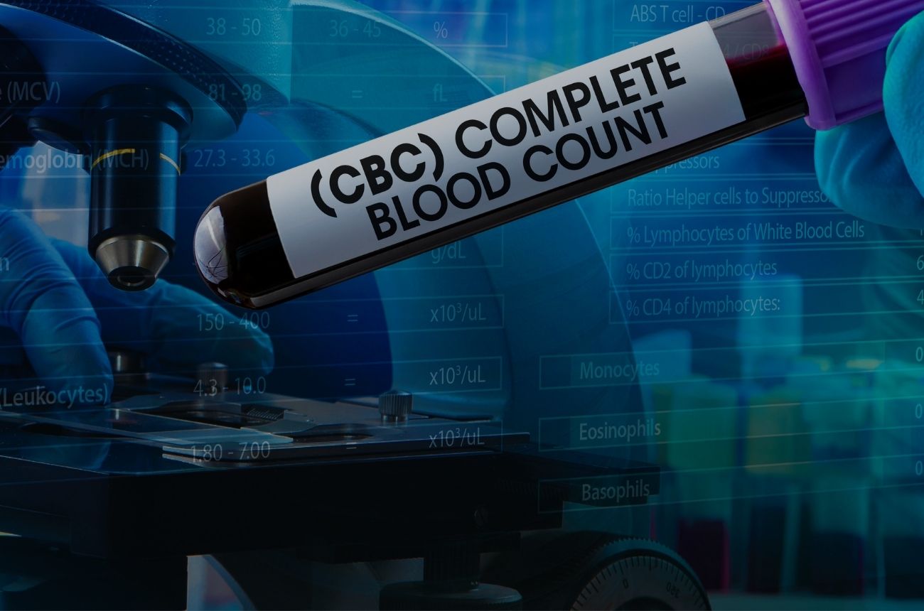 Online Alcohol Risk Assessment Pack By blog.cult.fit